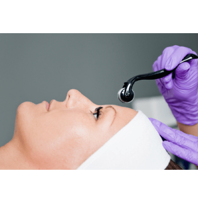 MICRONEEDLING
