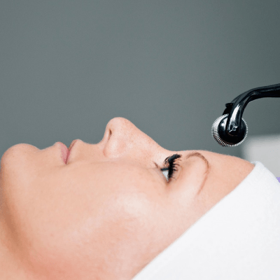 MICRONEEDLING