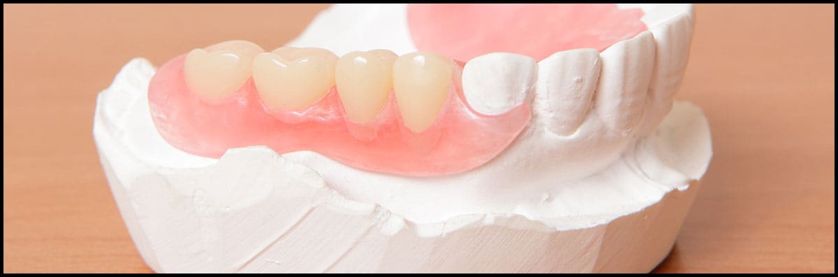 Dentures