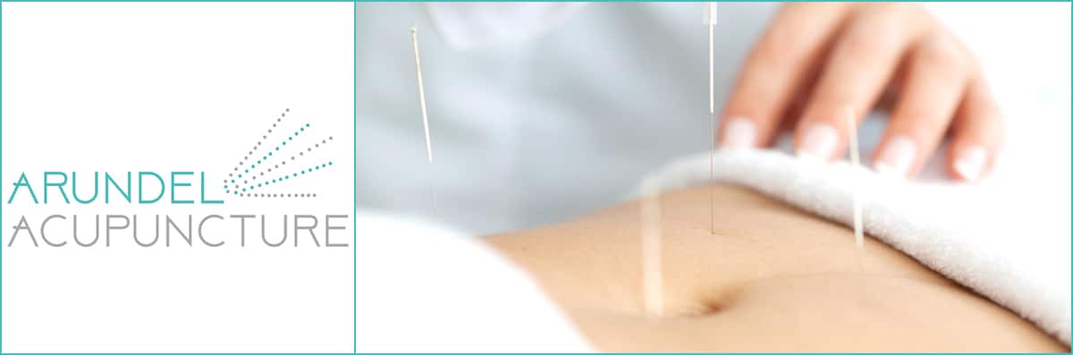 Acupuncture