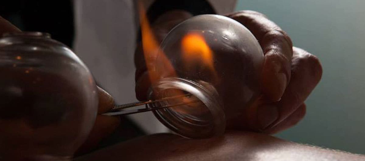 Traditional Chinese Medicine