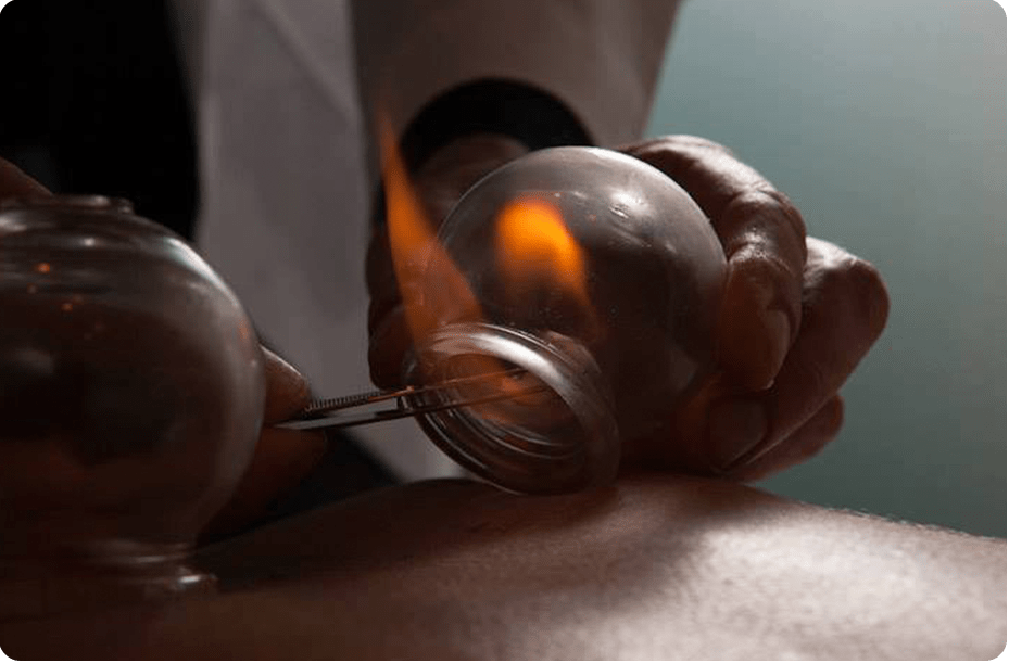 Traditional Chinese Medicine