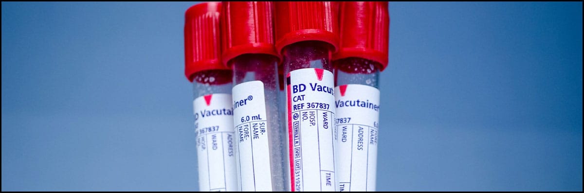 Functional Medicine Lab Work