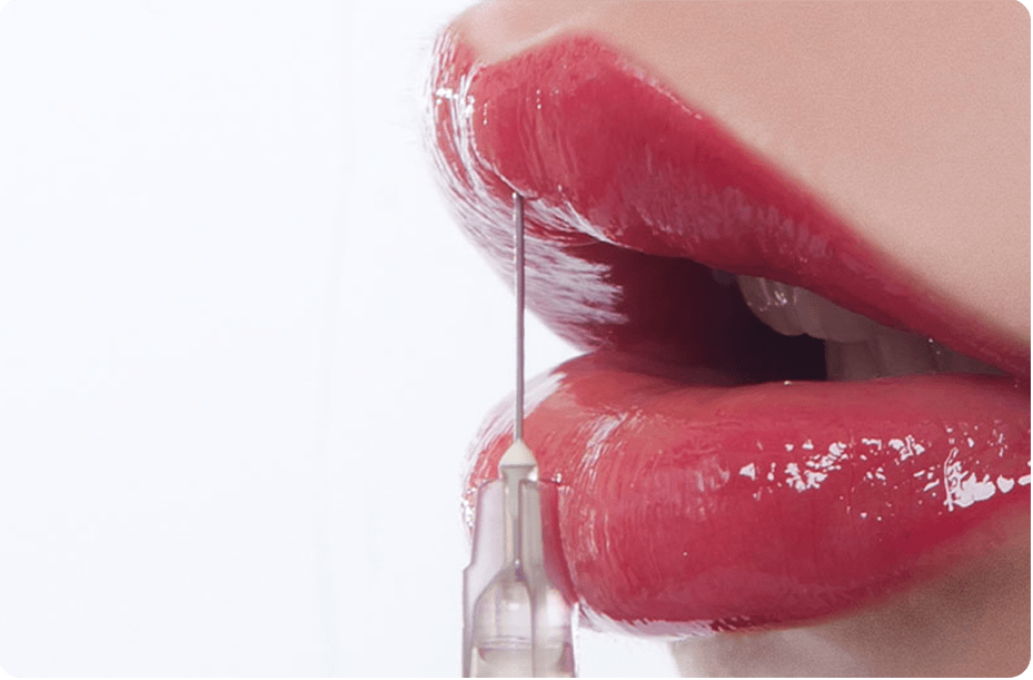 Lip Fillers