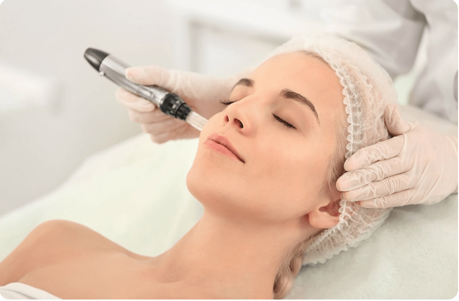 Microneedling