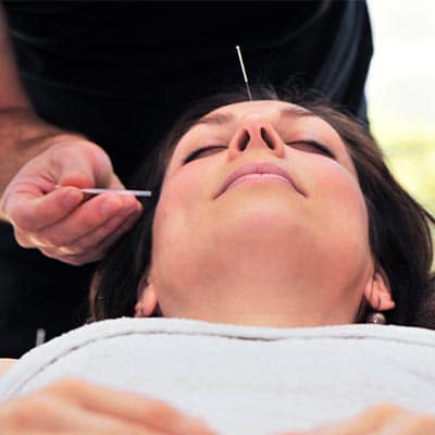 COSMETIC ACUPUNCTURE 