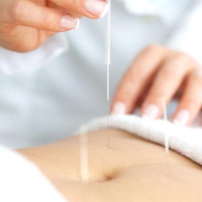 FERTILITY ACUPUNCTURE 