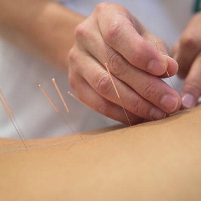 PAIN RELIEF ACUPUNCTURE 