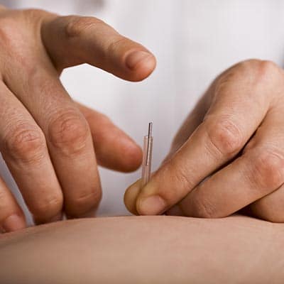 GASTROINTESTINAL ACUPUNCTURE 