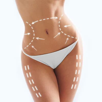 FAT REMOVAL