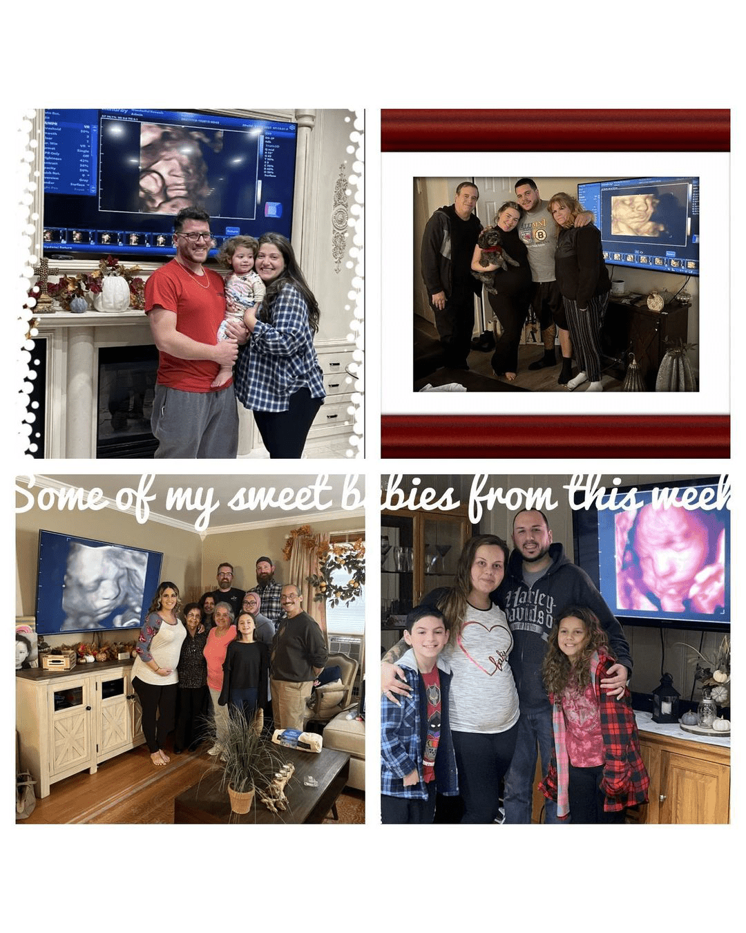 Keepsake Imaging 3D/4D Ultrasounds Offers Mobile InHome 4D Ultrasounds