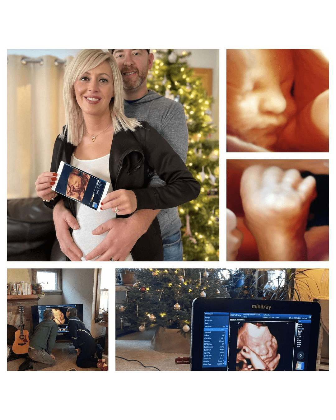 Keepsake Imaging 3D/4D Ultrasounds Offers Mobile InHome 4D Ultrasounds