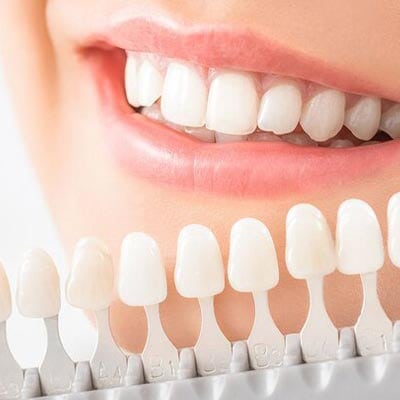 Cosmetic Dentistry