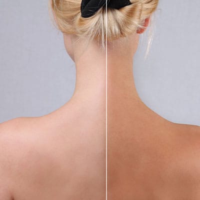 MOBILE SPRAY TANNING