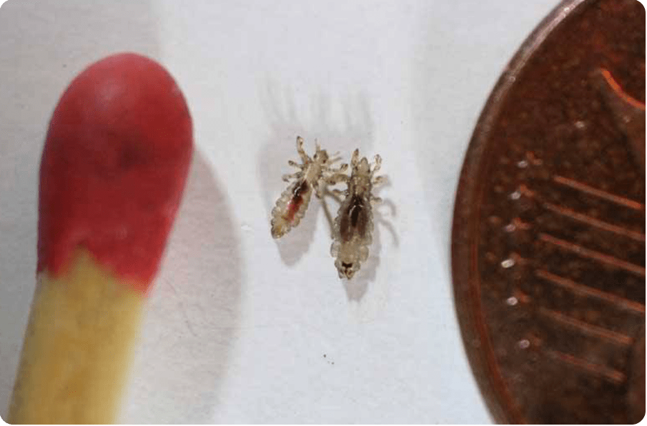 Head Lice Treatment
