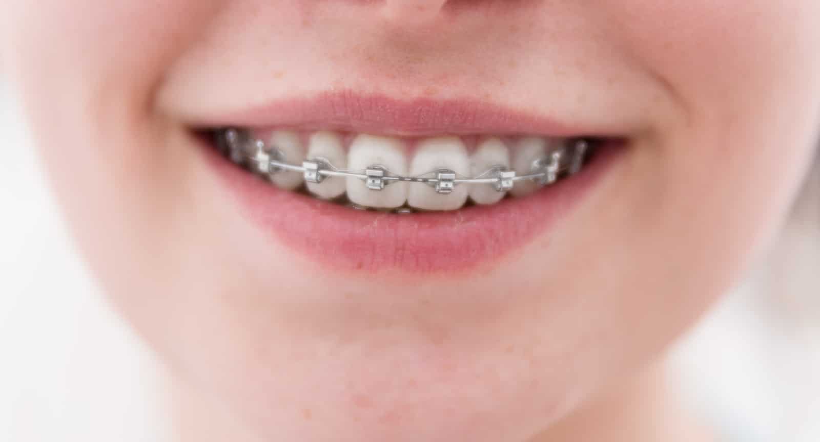 Dr. Howard Chen is an Orthodontist in Monterey Park, CA 91754