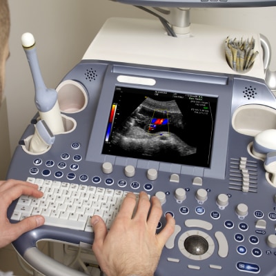 ULTRASOUND