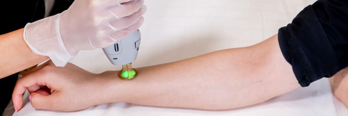 Laser Services